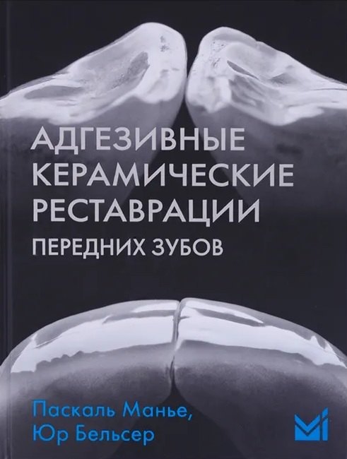 Юр Бельсер: Адгезивные керамические реставрации передних зубов