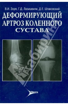 Зоря Василий Иосифович: Деформирующий артроз коленного сустава: руководство