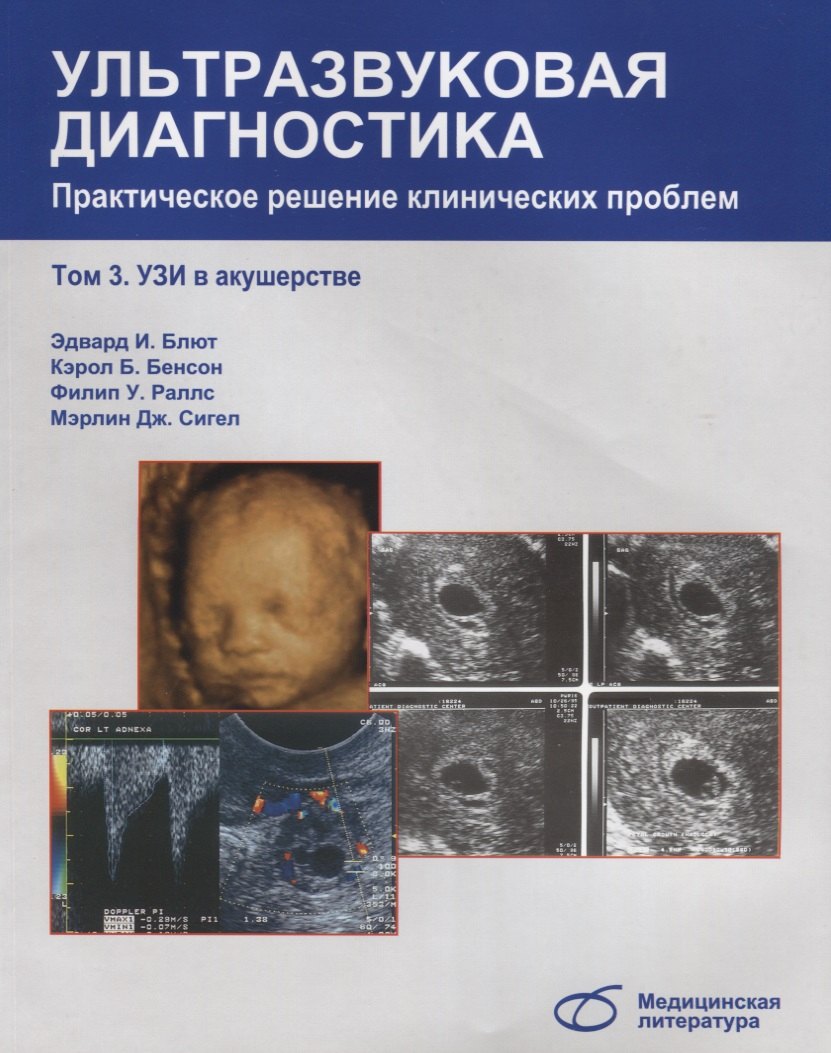 И. Блют Эдвард: Ультразвуковая диагностика. Практическое решение клинических проблем, т. 3. УЗИ в акушерстве