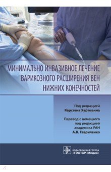 Алм Дженс: Минимально инвазивное лечение варикозного расширения вен