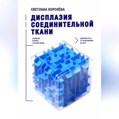 Королева Светлана: Дисплазия соединительной ткани.