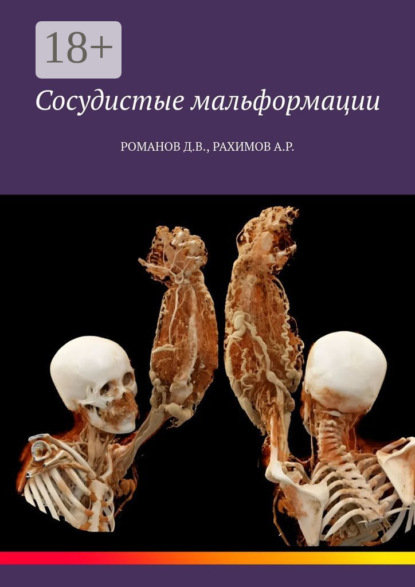 Романов Дмитрий: Сосудистые мальформации