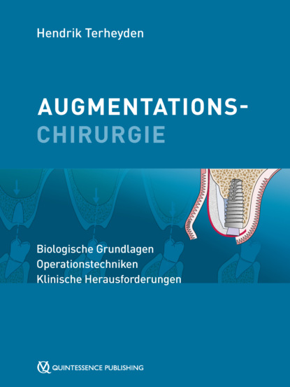 Terheyden Hendrik: Augmentationschirurgie
