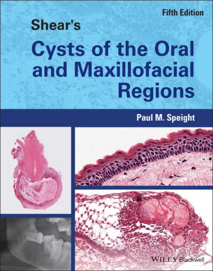 M. Paul Speight: Shear's Cysts of the Oral and Maxillofacial Regions