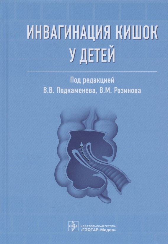 Владимирович Подкаменев Владимир: Инвагинация кишок у детей