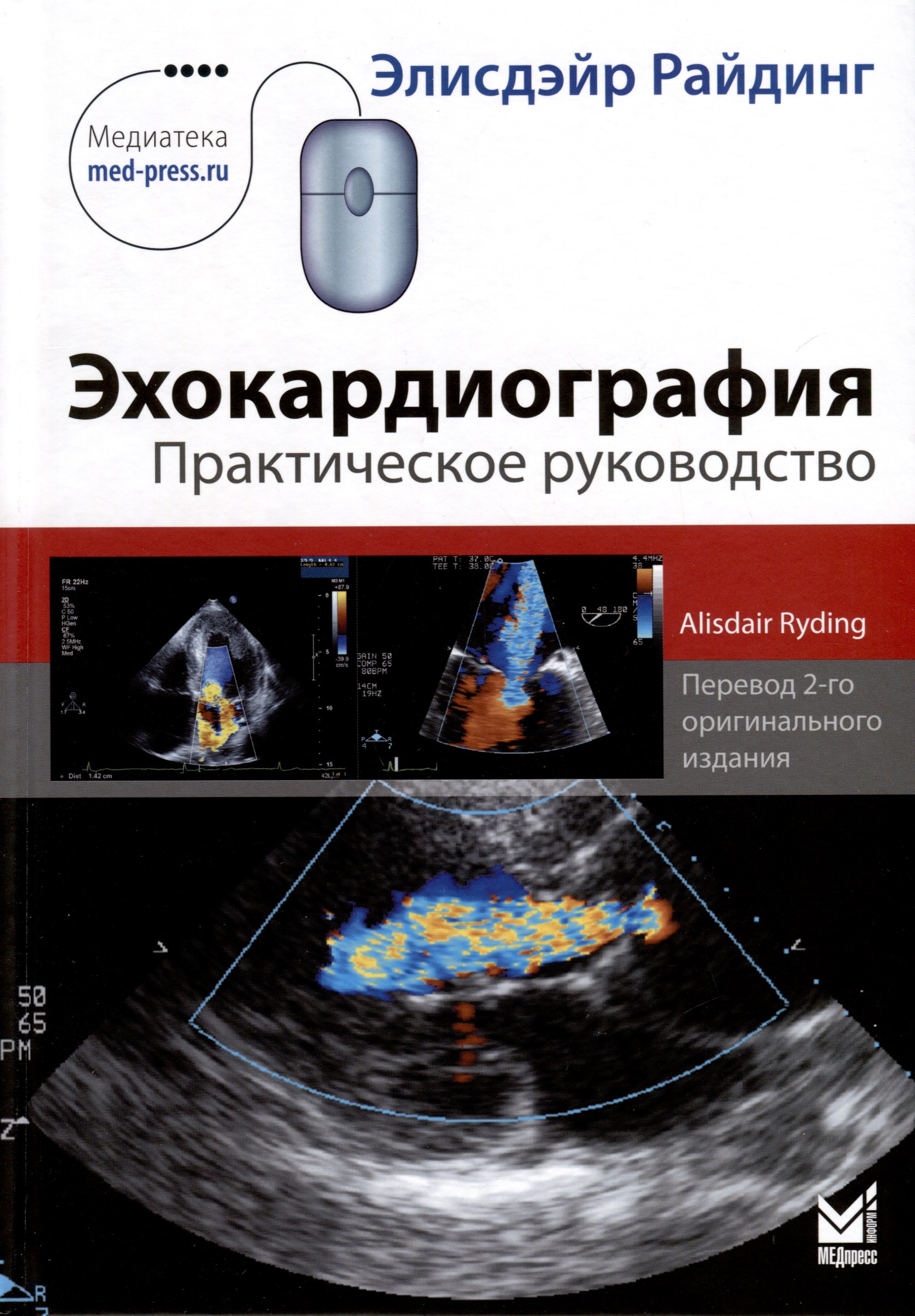 Райдинг Элисдэйр: Эхокардиография. Практическое руководство.