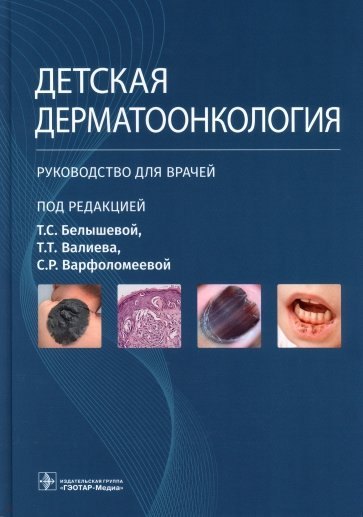Сергеевна Белышева Татьяна: Детская дерматоонкология. Руководство для врачей