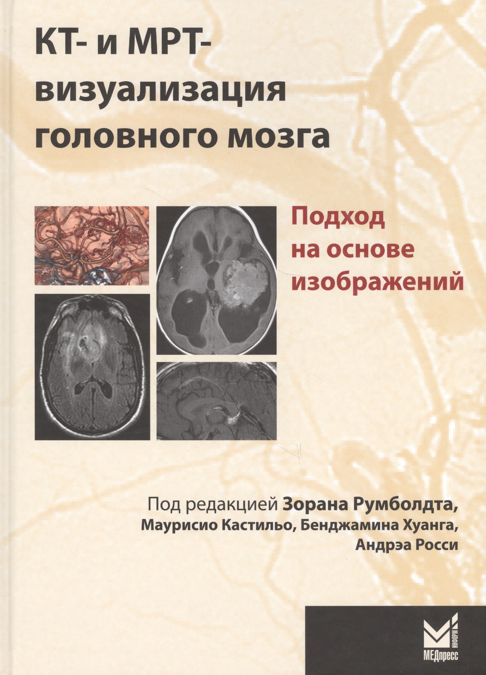 Зоран Румболдт: КТ-и МРТ-визуализация головного мозга.подход на основе