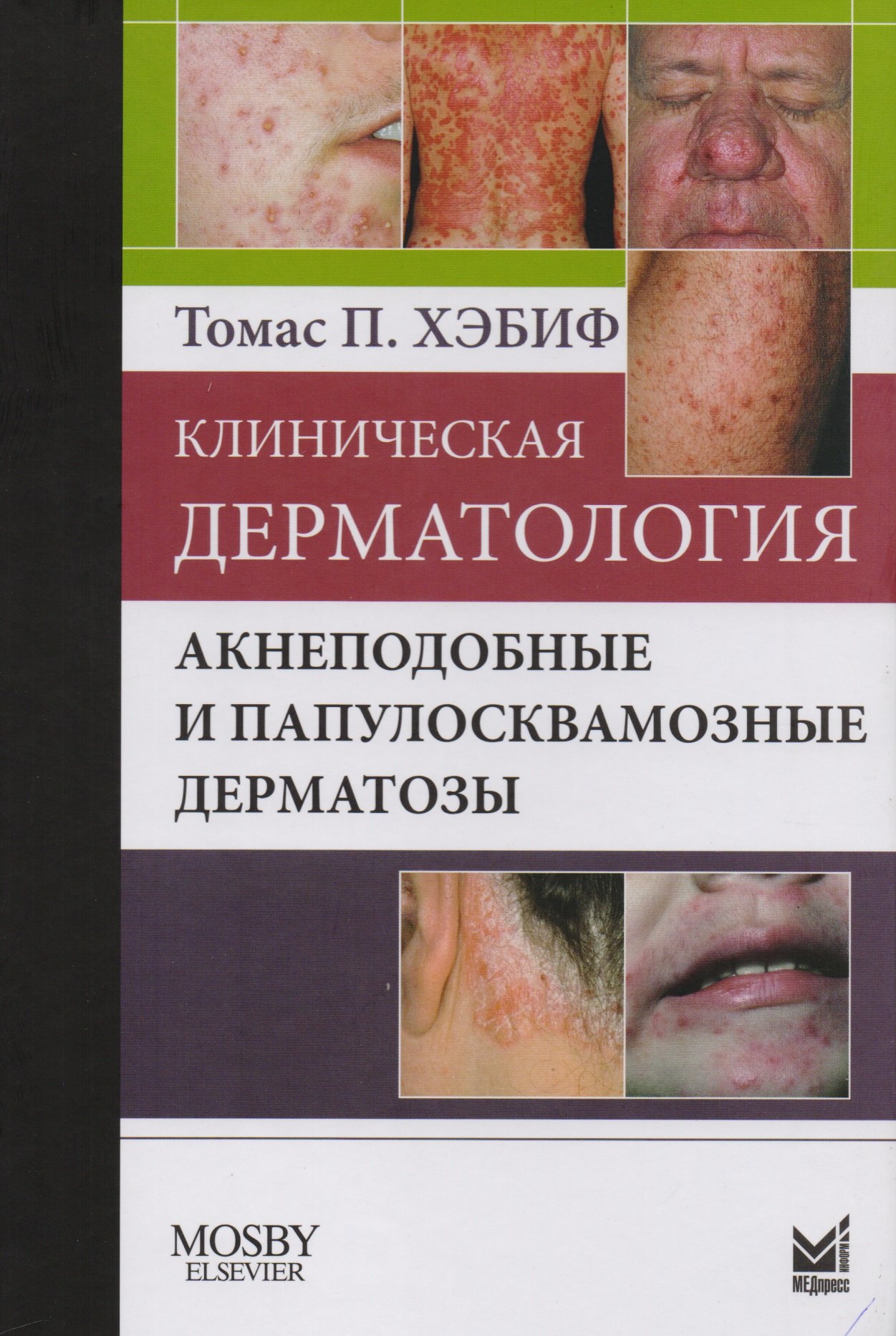 П. Хэбиф Томас: Клиническая дерматология. Акнеподобные и папулосквамозные дерматозы