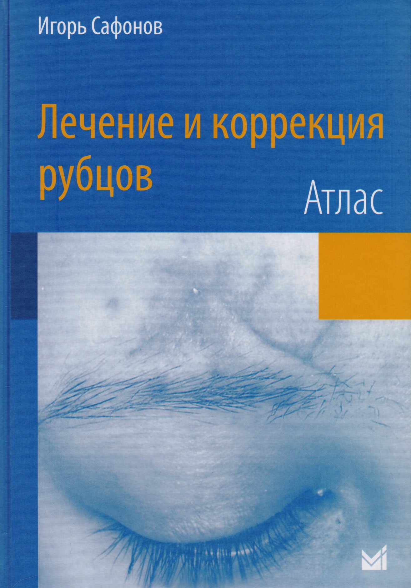 Игорь Сафонов: Лечение и коррекция рубцов.Атлас