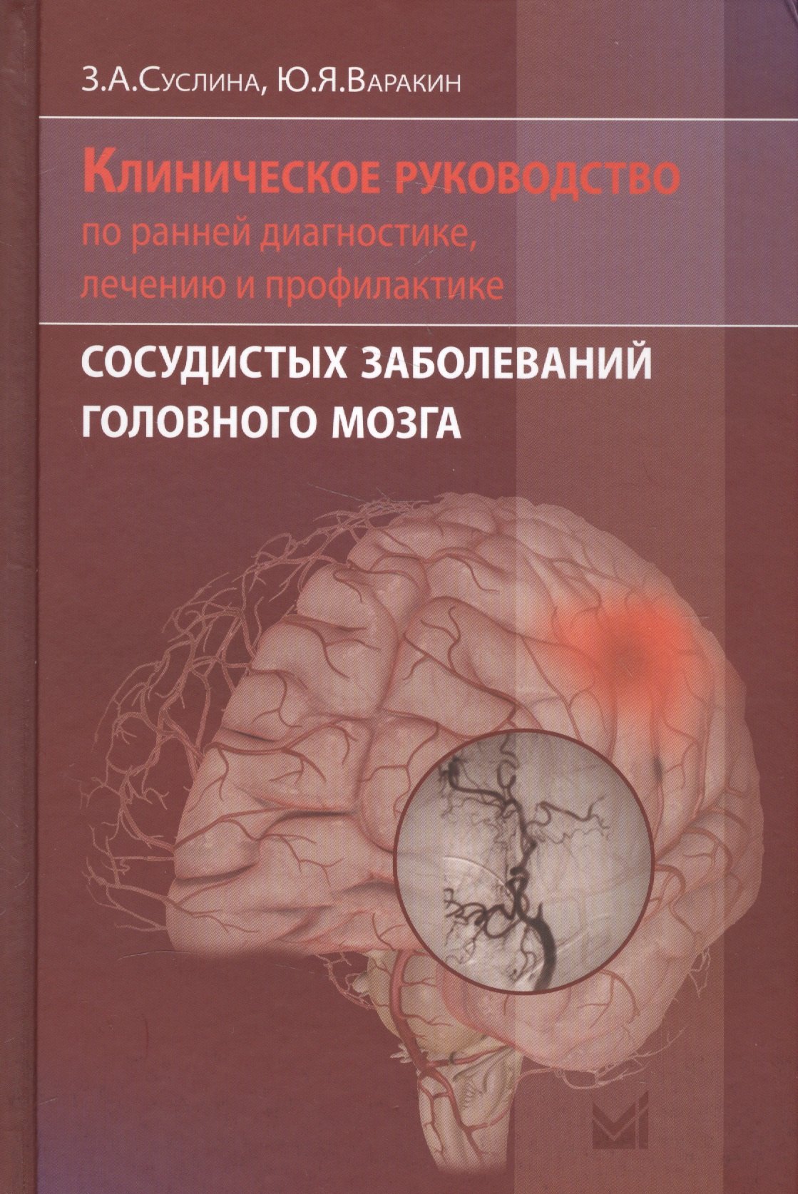 Суслина Зинаида Александровна: Клиническое руководство по ранней диагностике, лечению и профилактике сосудистых заболеваний головного мозга