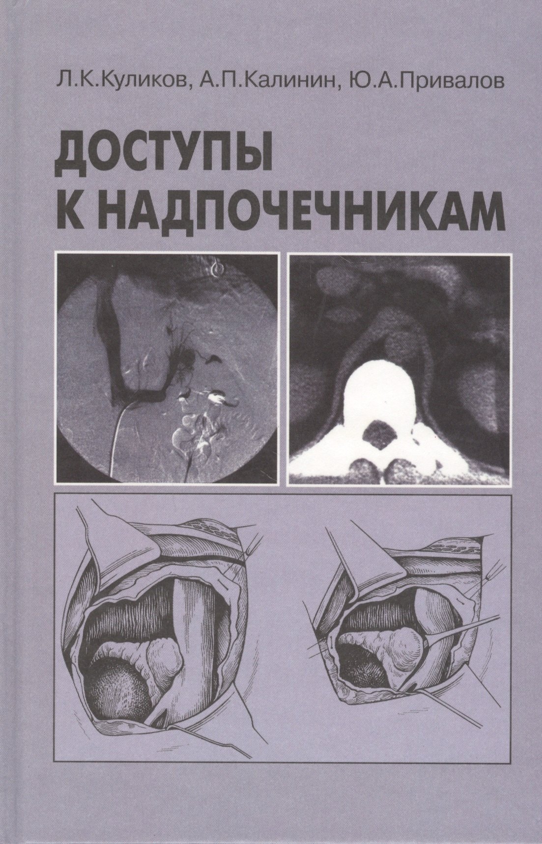 Константинович Куликов Леонид: Доступы к надпочечникам. Руководство для врачей