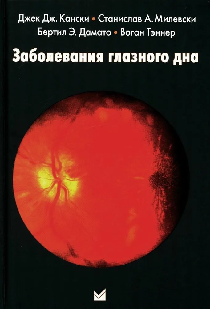 Дж. Кански Джек: Заболевания глазного дна