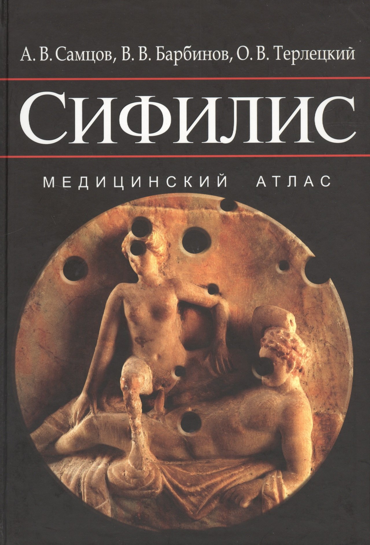 Викторович Самцов Алексей: Сифилис. Медицинский атлас