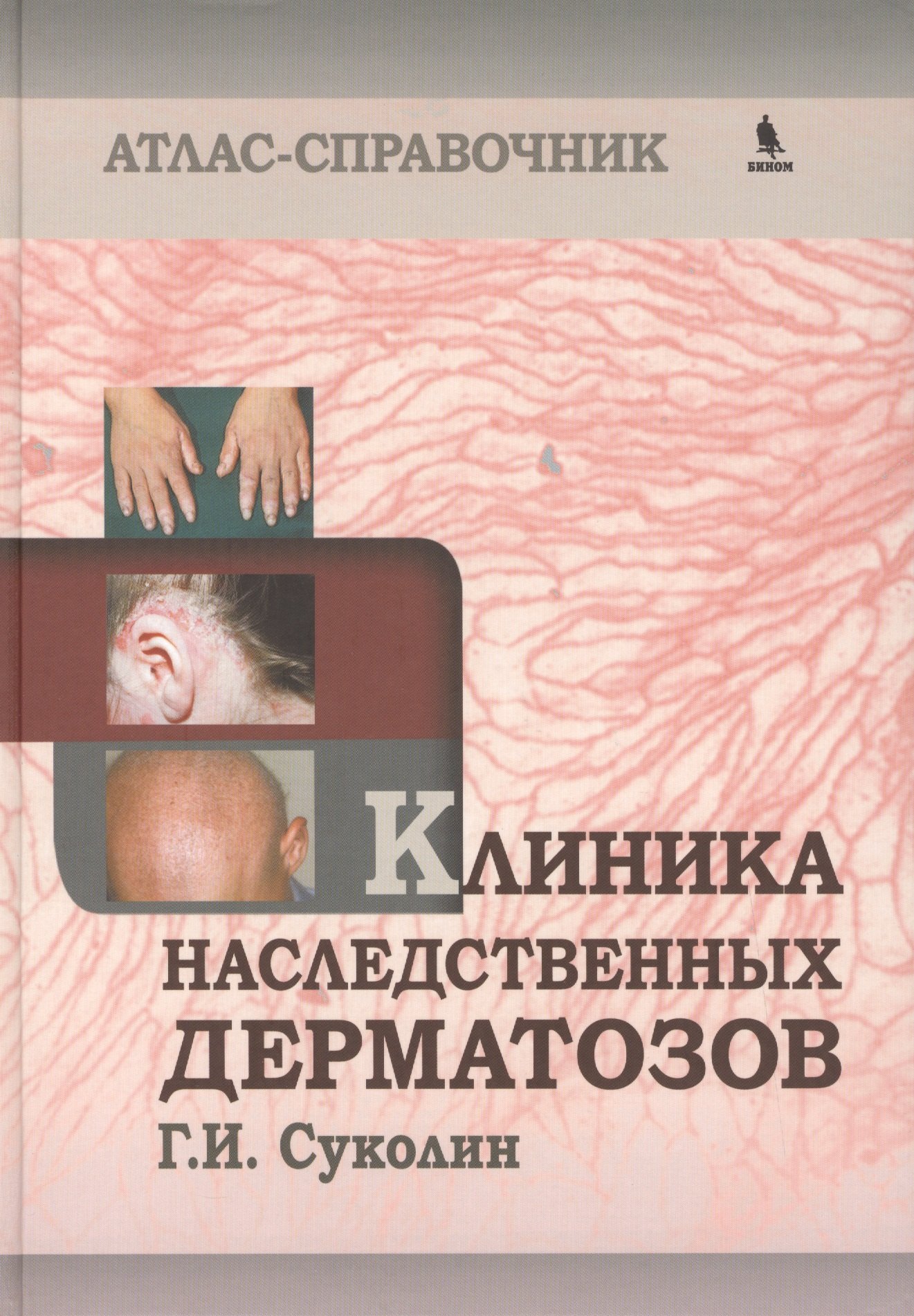 Г.И. Суколин: Клиника наследственных дерматозов. Атлас-справочник