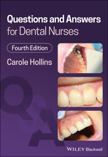 Hollins Carole: Questions and Answers for Dental Nurses
