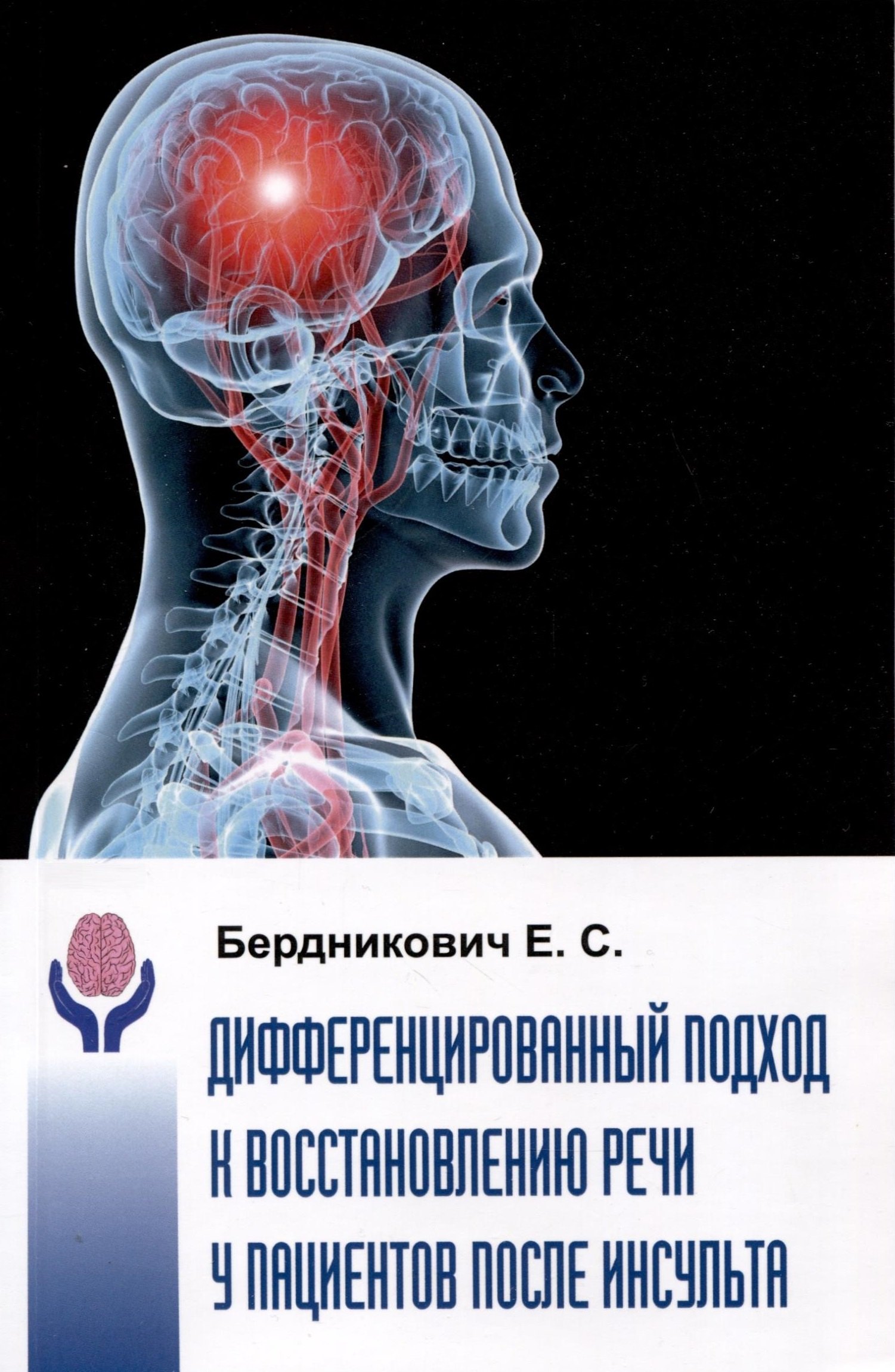 Бердникович Елена Семеновна: Дифференциальный подход к восстановлению речи у пациентов после инсульта