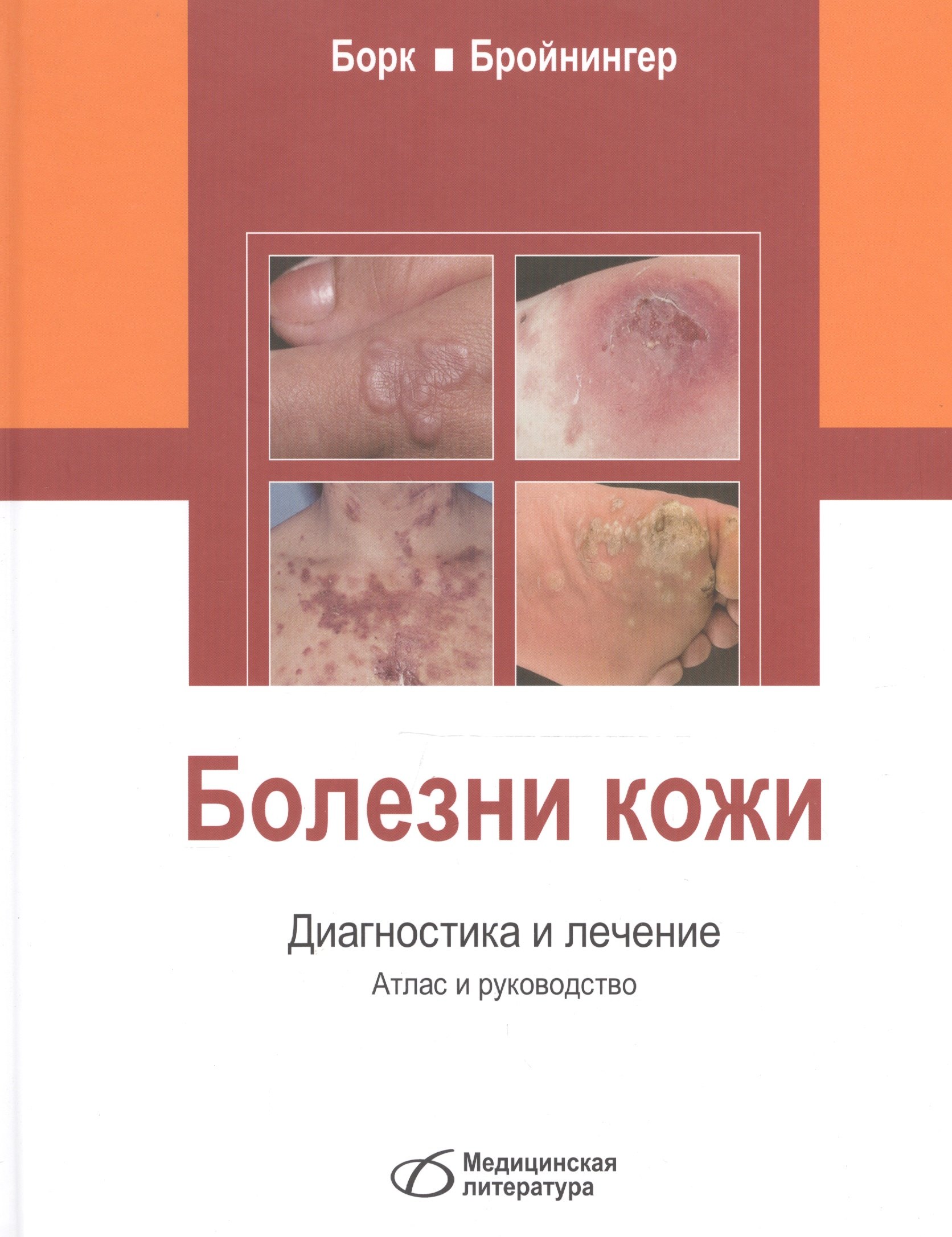 Конрад Борк: Болезни кожи. Диагностика и лечение