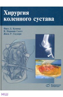 Кушнер Фред Д.: Хирургия коленного сустава