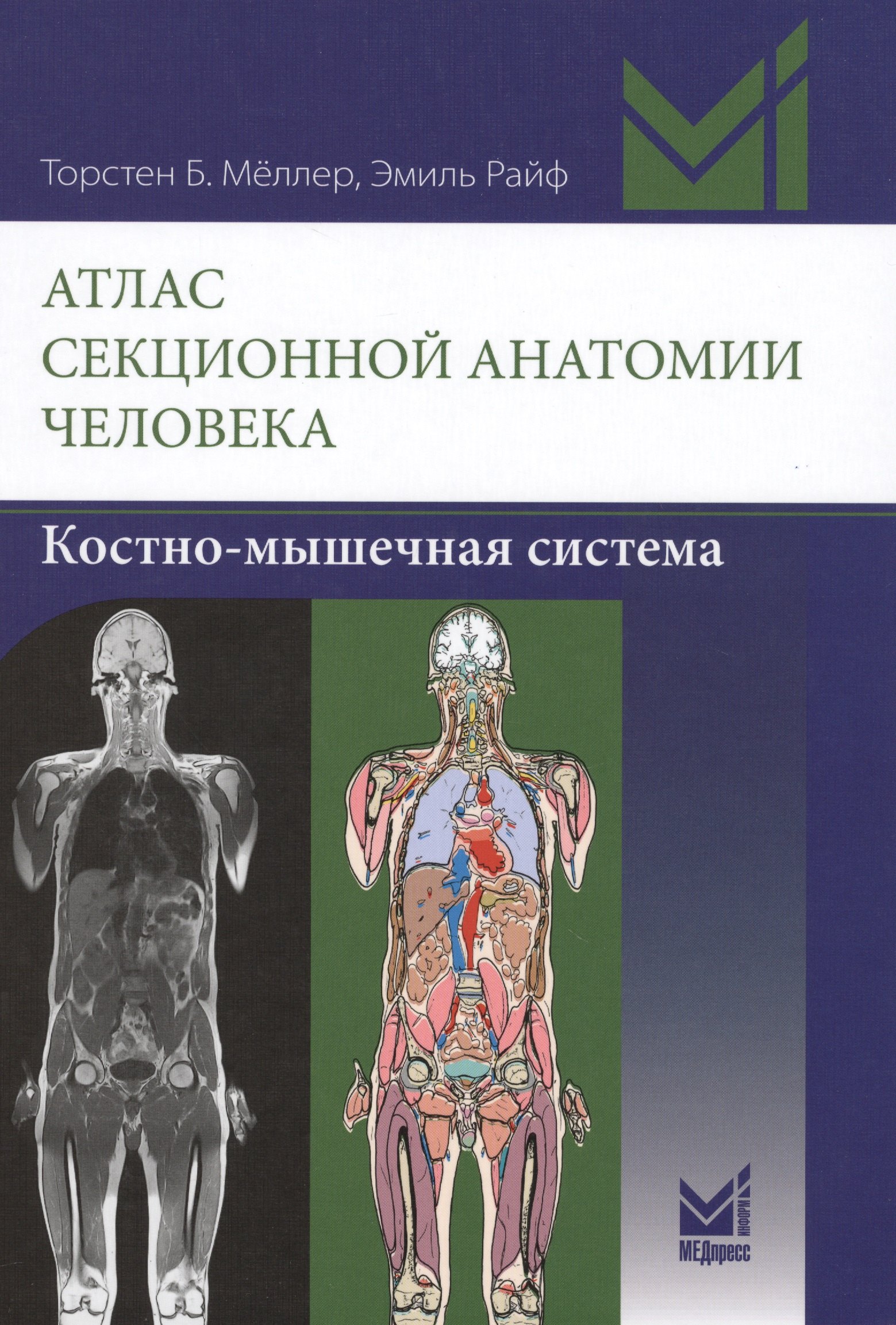 Б. Меллер Торстен: Атлас секционной анатомии человека. Костно-мышечная система