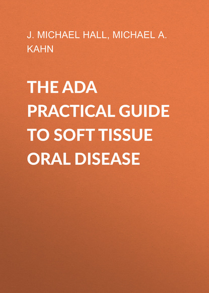 Hall J. M.: The ADA Practical Guide to Soft Tissue Oral Disease