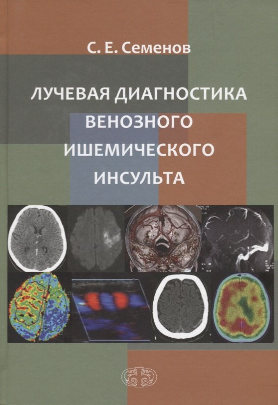 Евгеньевич Семенов Станислав: Лучевая диагностика венозного ишемического инсульта