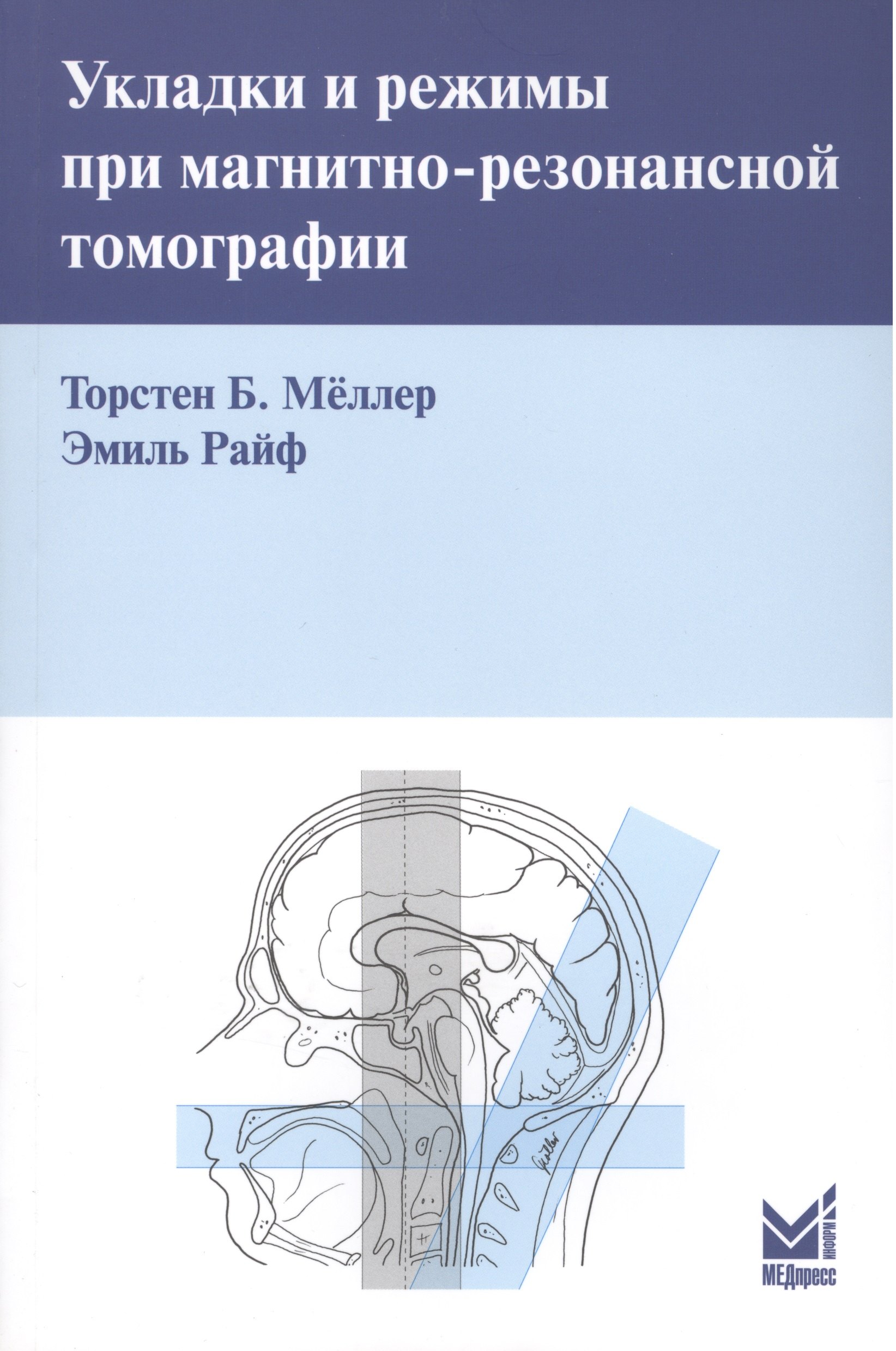 Б. Меллер Торстен: Укладки и режимы при магнитно-резонансной томографии.