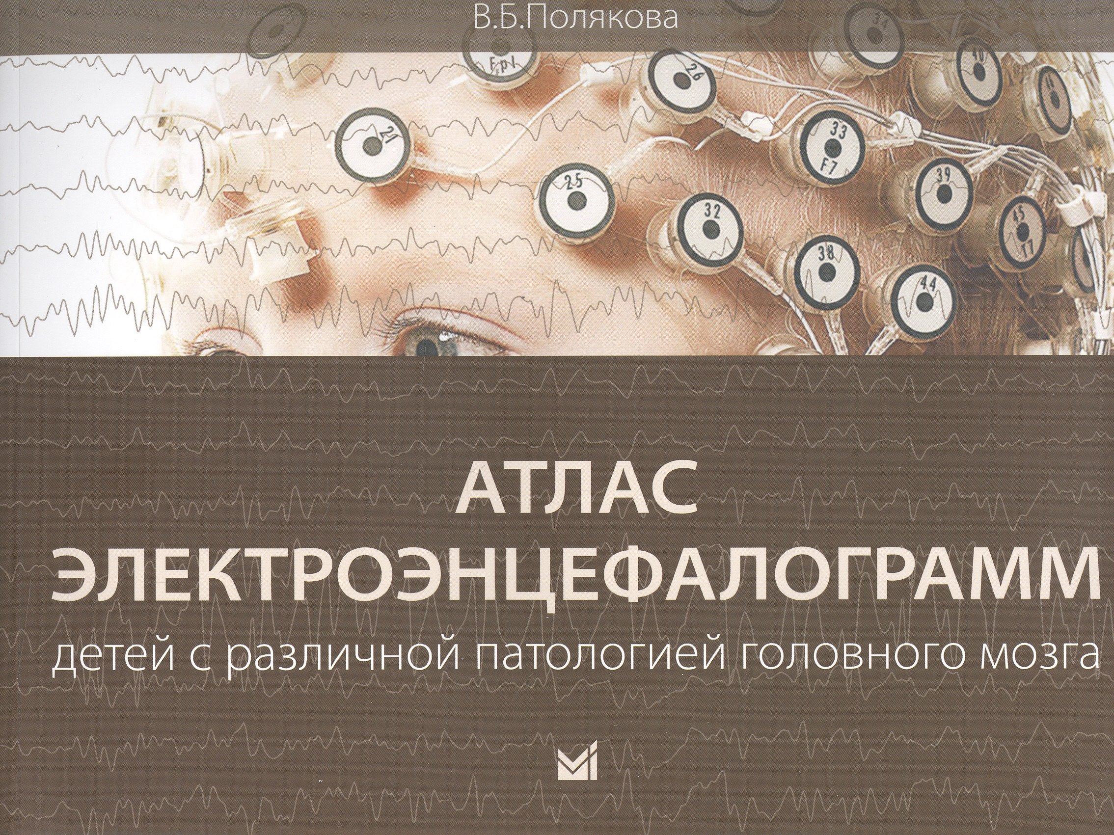 Борисовна Полякова Вера: Атлас электроэнцефалограмм детей с различной патологией головного мозга