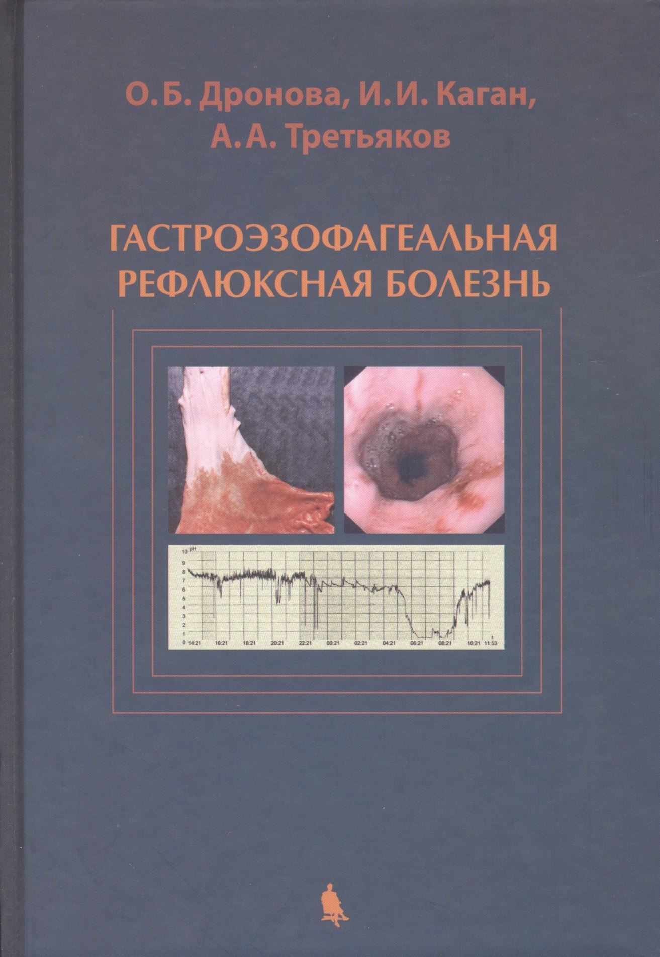 Дронова Ольга Борисовна: Гастроэзофагеальная рефлюксная болезнь