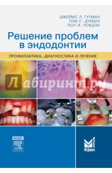 Гуиман Джеймс Л.: Решение проблем в эндодонтии. Профилактика, диагностика и лечение
