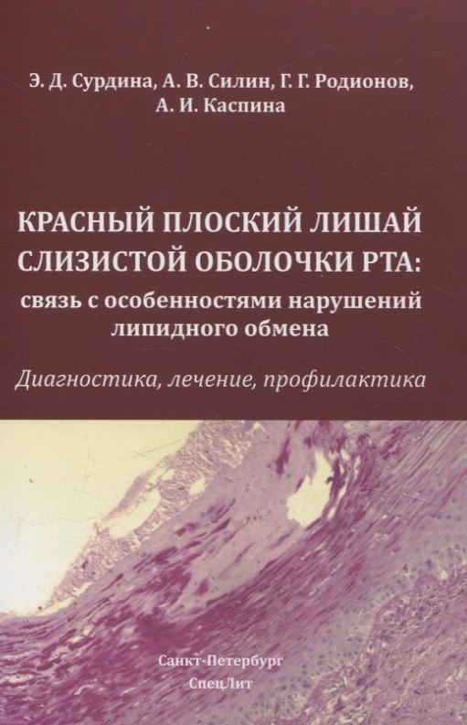 Игнатьевна Каспина Алевтина: Красный плоский лишай слизистой оболочки рта: связь с особенностями нарушений липидного обмена