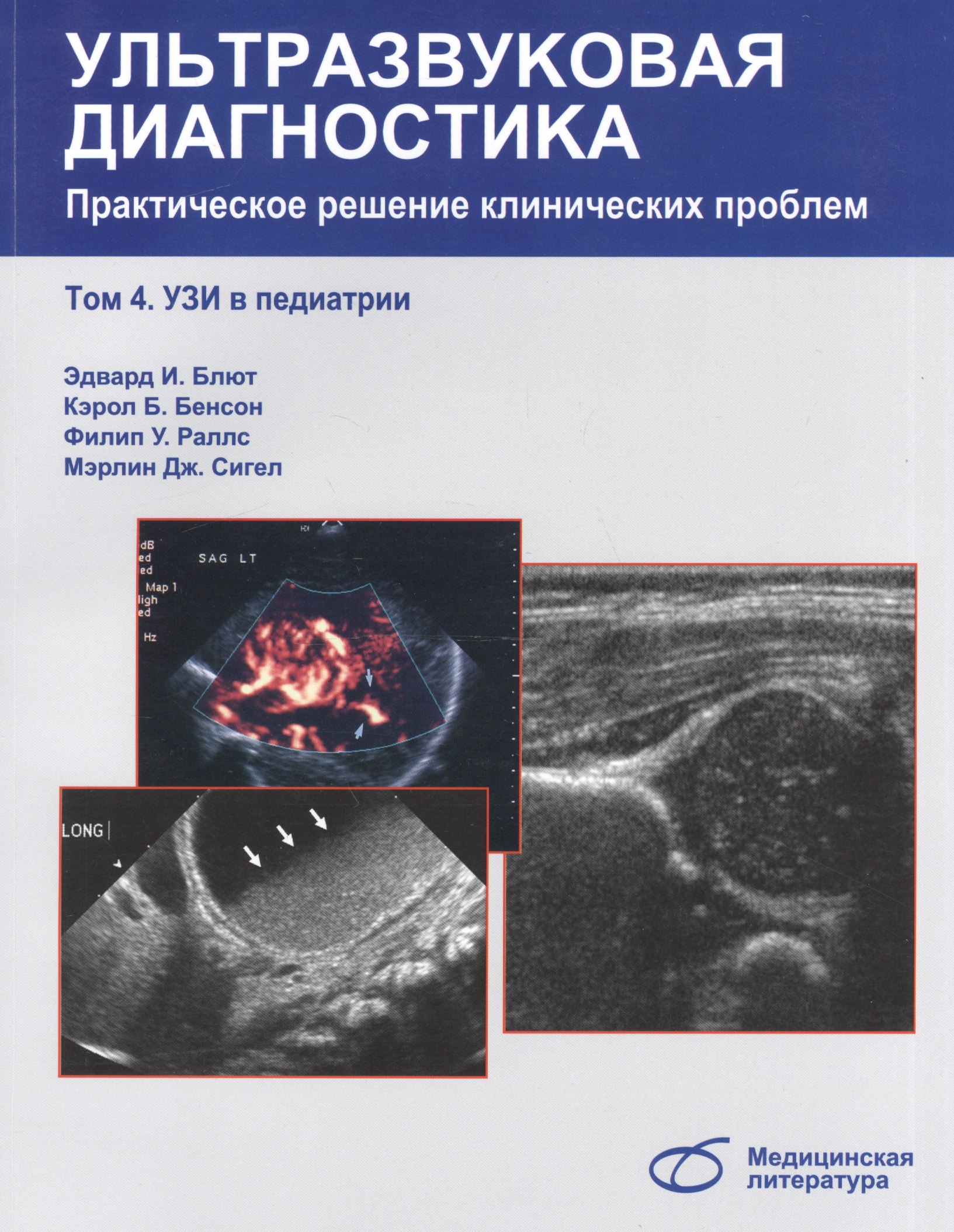 Блют Эдвард И.: Ультразвуковая диагностика. Практическое решение клинических проблем, т. 4. УЗИ в педиатрии