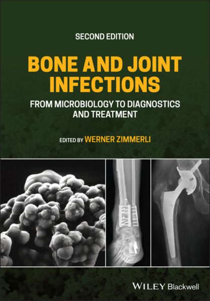 авторов Группа: Bone and Joint Infections