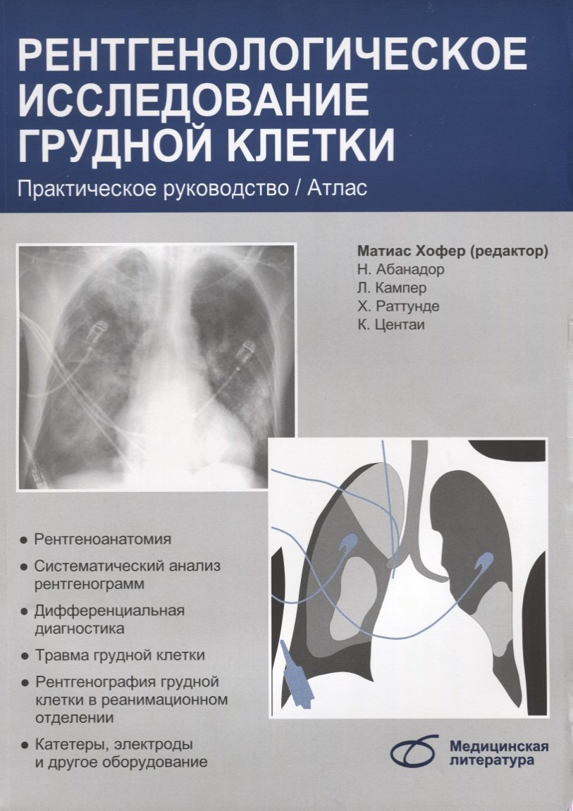 Матиас Хофер: Рентгенологическое исследование грудной клетки