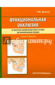 Доусон Питер Е.: Функциональная окклюзия. От височно-нижнечелюстного сустава до планирования улыбки