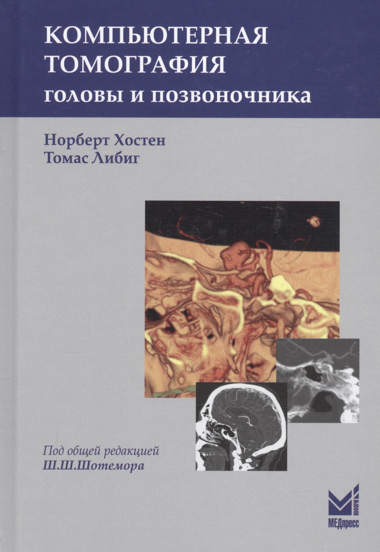 Норберт Хостен: Компьютерная томография головы и позвоночника