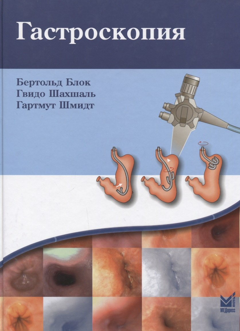 Бертольд Блок: Гастроскопия