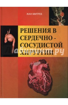 Митрев Жан: Решения в сердечно-сосудистой хирургии
