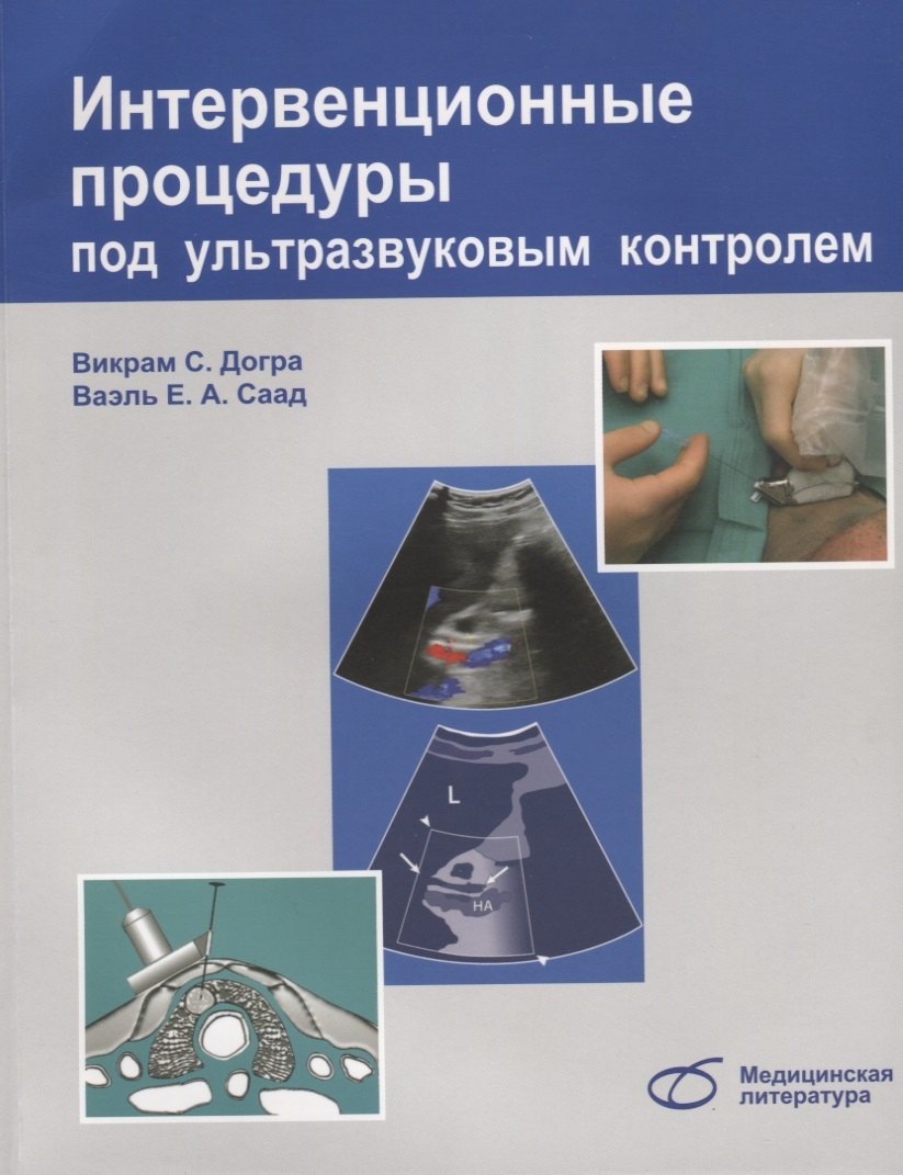 Догра Викрэм: Интервенционные процедуры под ультразвуковым контролем (м) Догра