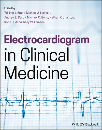 авторов Группа: Electrocardiogram in Clinical Medicine