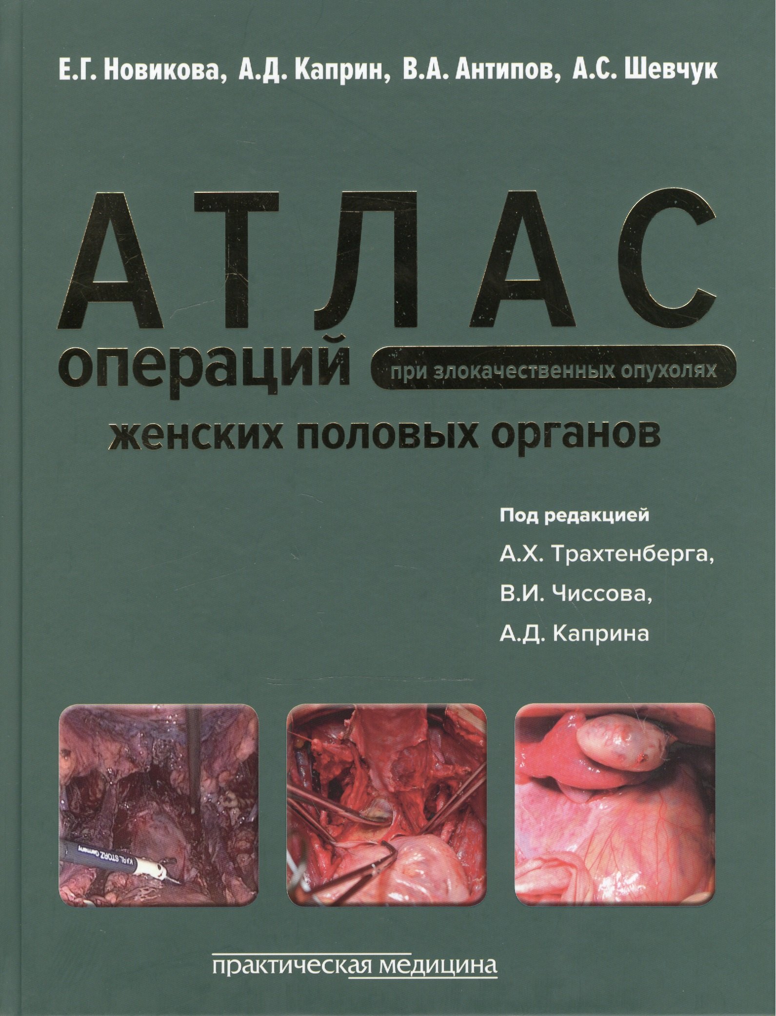 Атлас операций при злокачественных опухолях женских половых органов (Новикова)