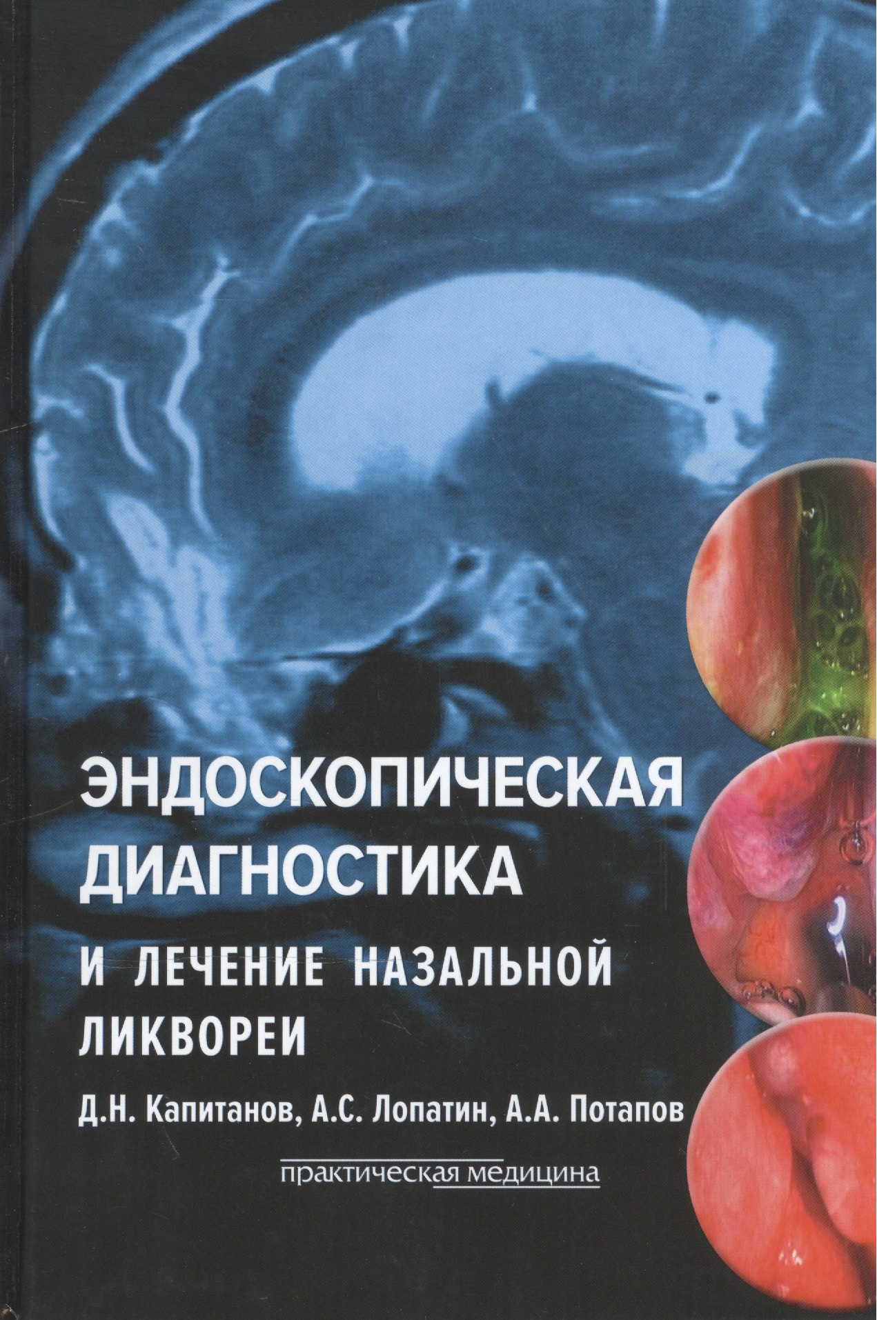 Станиславович Лопатин Андрей: Эндоскопическая диагностика и лечение назальной ликвореи