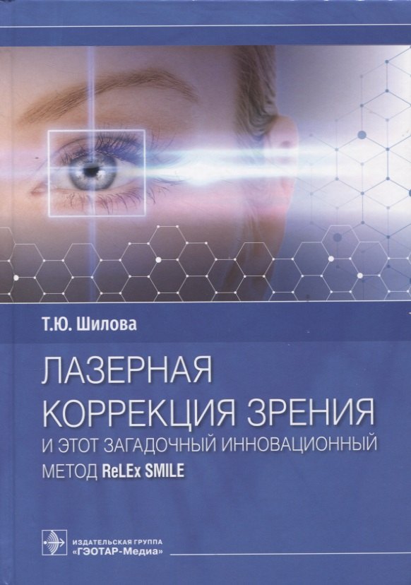 Юрьевна Шилова Татьяна: Лазерная коррекция зрения и этот загадочный инновационный метод ReLEx SMILE