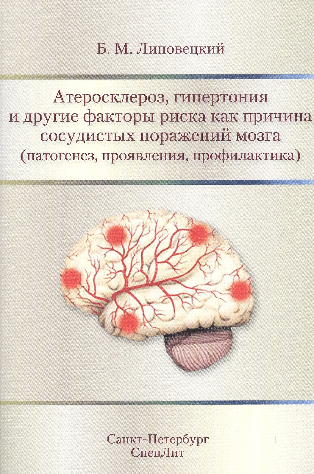 Маркович Липовецкий Борис: Атеросклероз,гипертония и другие факторы риска как причина с