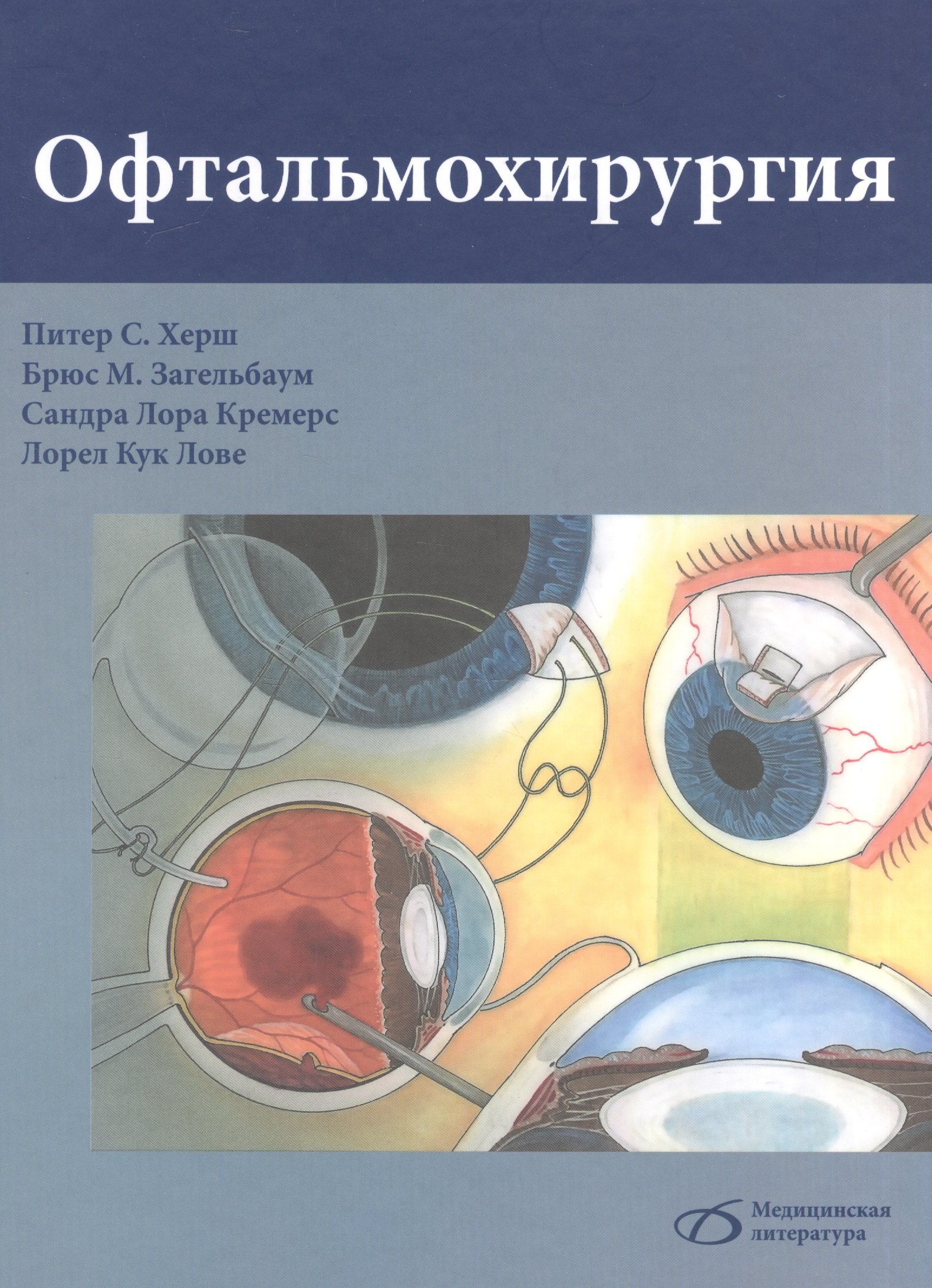 С. Херш Питер: Офтальмохирургия