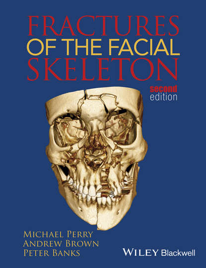 Perry Michael: Fractures of the Facial Skeleton