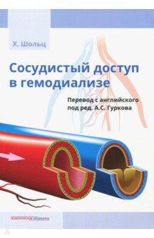 Шольц Ханс: Сосудистый доступ в гемодиализе