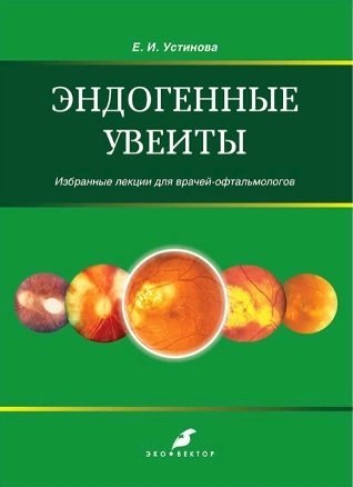 Ивановна Устинова Елена: Эндогенные увеиты