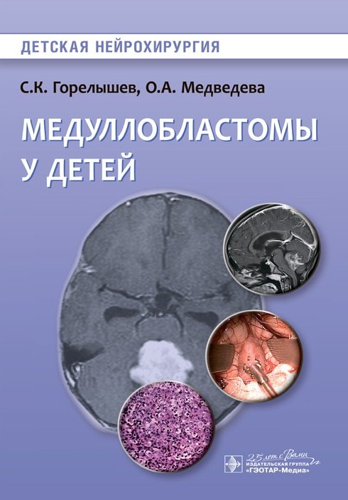 Владимирович Горелышев Сергей: Медуллобластомы у детей