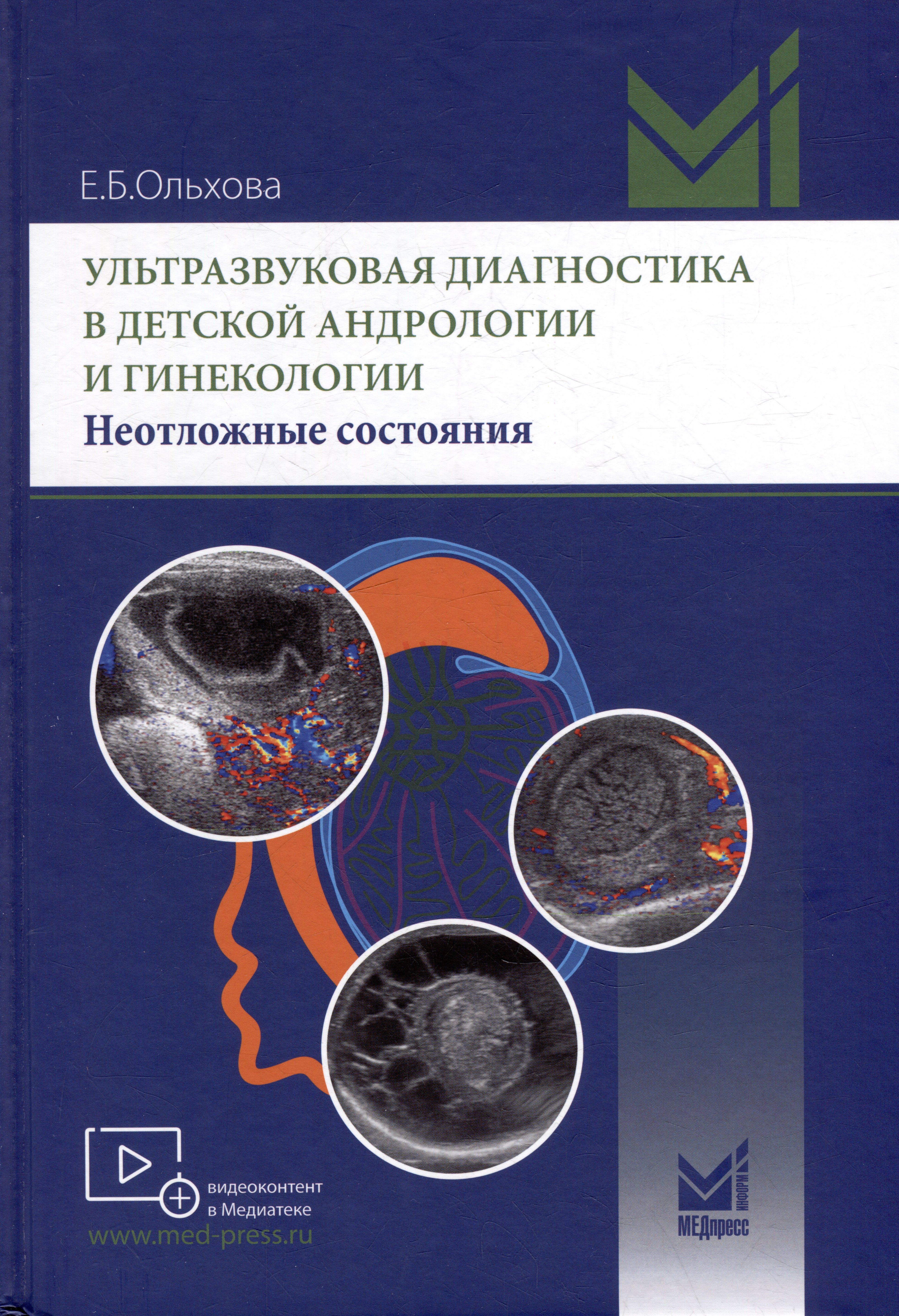 Борисовна Ольхова Елена: Ультразвуковая диагностика в детской андрологии и гинекологии. Неотложные состояния